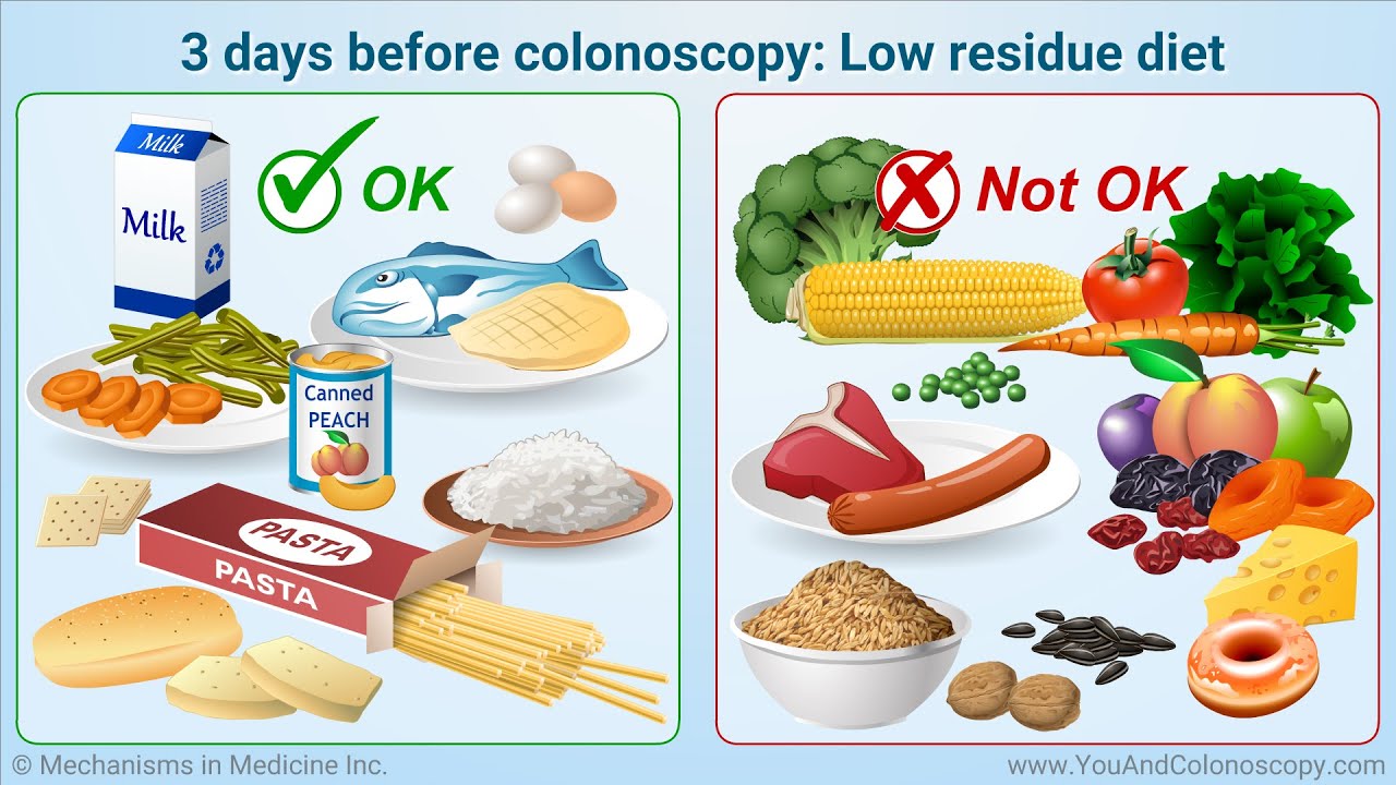 Practical Guide to Low Residue Diet for Colonoscopy: Essential Tips for 2025