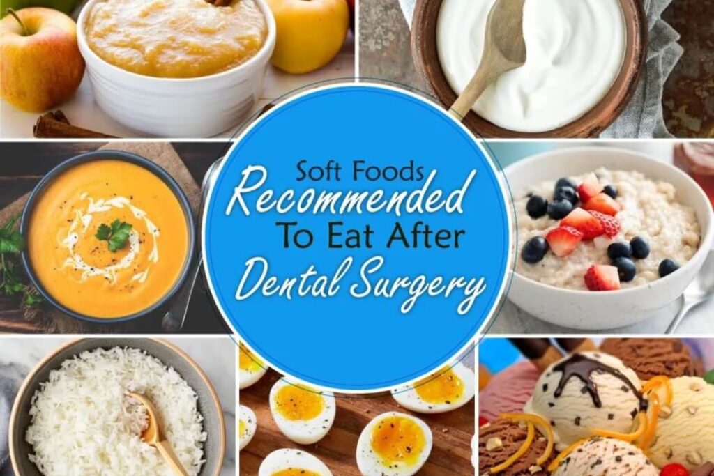 Best 7 Soft Food Diet Options for Quick Recovery After Surgery in 2025